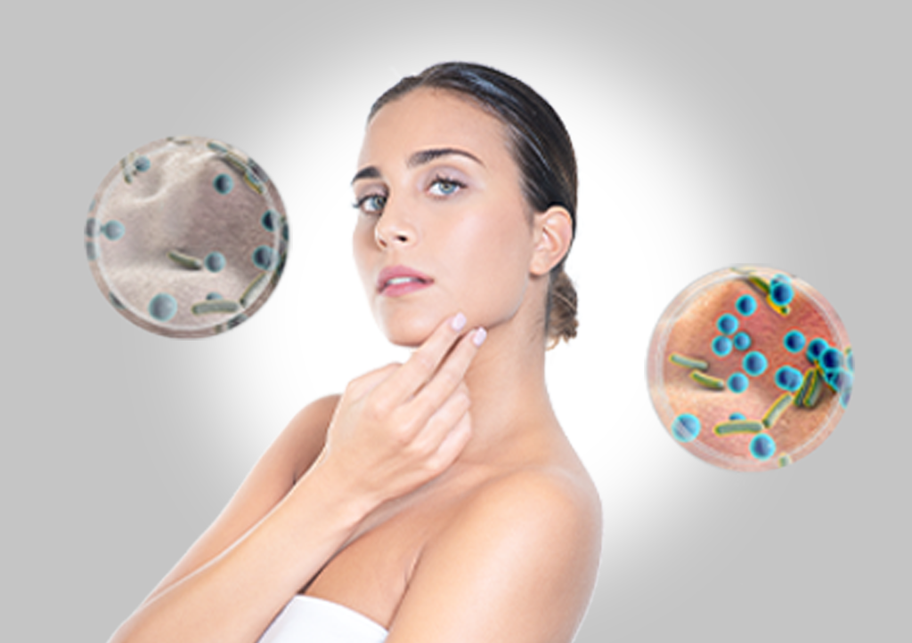 MICROBIOTA CUTANEO